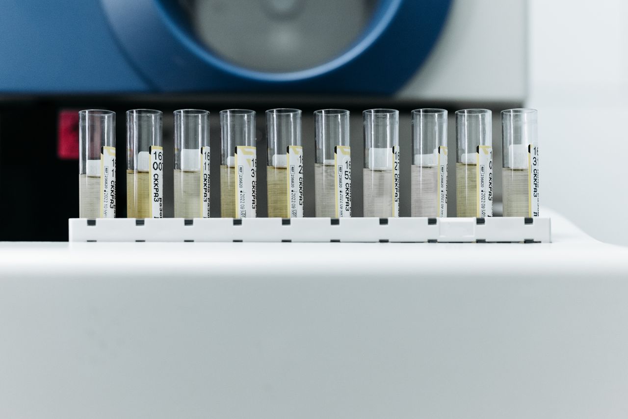 Biologisch geslacht: de gameten-definitie